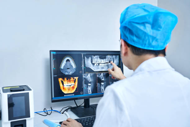 Best Emergency Root Canal Treatment in Auburn, WA